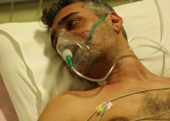 Ο Βολκάν στην εντατική στη σειρά Άπιστος